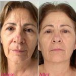 کلینیک پوست و زیبایی ژیلاوَش