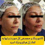 کلینک زیبایی دکتر مریم پوررهنما