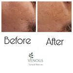 خدمات پوست ونوس