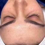 کلینیک فیشال و ماساژ سارن اسکین سارا