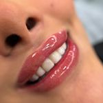 میکروبلیدینگ میناسلمانی