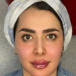 کلینیک پوست سلین - کلینیک پوست و مو - شهر شیراز - 0030