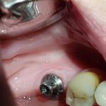 مطب دندانپزشکی دکتر روح اله میراحمدی