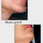 مرکز لیزر و پاکسازی پوست سحر