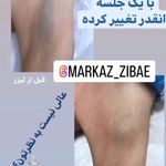 مرکز لیزر و پاکسازی پوست سحر