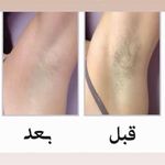 مرکز لیزر و پاکسازی پوست سحر