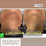مرکز لیزر و پاکسازی پوست سحر