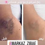 مرکز لیزر و پاکسازی پوست سحر