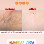 مرکز لیزر و پاکسازی پوست سحر