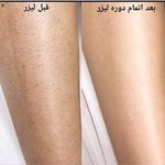 مرکز لیزر و پاکسازی پوست سحر