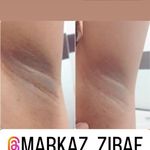 مرکز لیزر و پاکسازی پوست سحر