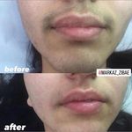 مرکز لیزر و پاکسازی پوست سحر