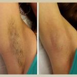 مرکز لیزر و پاکسازی پوست سحر