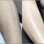 مرکز لیزر و پاکسازی پوست سحر