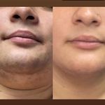 مرکز لیزر و پاکسازی پوست سحر