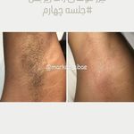 مرکز لیزر و پاکسازی پوست سحر