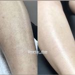 مرکز لیزر و پاکسازی پوست سحر