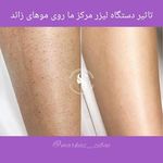 مرکز لیزر و پاکسازی پوست سحر