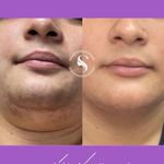 مرکز لیزر و پاکسازی پوست سحر