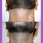 مرکز لیزر و پاکسازی پوست سحر