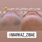 مرکز لیزر و پاکسازی پوست سحر