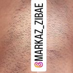 مرکز لیزر و پاکسازی پوست سحر