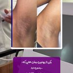 مرکز لیزر و پاکسازی پوست سحر