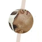 مرکز لیزر و پاکسازی پوست سحر