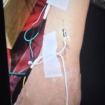 فیزیوتراپی سینا  شریفی 