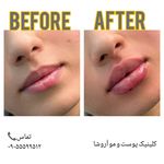مرکز زیبایی,بوتاکس و لیزر آروشا