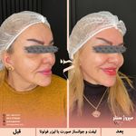 مرکز پزشکی و زیبایی میروژ سنتر