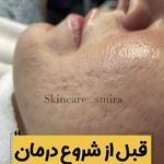 فیشال تخصصی و سالن پاکسازی پوست کامیابی