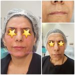 کلینیک زیبایی و لیزر مایا (دکتر وحیدی)