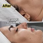 مرکز تخصصی فیشال و پاکسازی پوست تینا