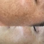 فیشیال / خدمات پوست / سالن زیبایی