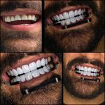دندانپزشکی زیبایی
