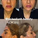 کلینیک زیبایی دکتر هدیه دهقانپور