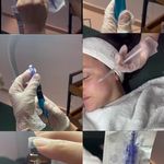 مرکز پوست مو لیزر نگارین