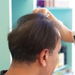 کلینیک پوست، مو، لیزر آنست