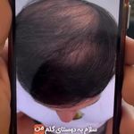 کلینیک پوست، مو، لیزر آنست