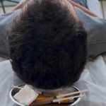 کلینیک پوست، مو، لیزر آنست