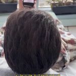 کلینیک پوست، مو، لیزر آنست