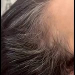 کلینیک پوست، مو، لیزر آنست