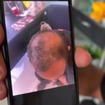 کلینیک پوست، مو، لیزر آنست