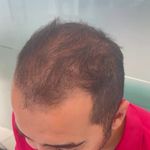 کلینیک پوست، مو، لیزر آنست