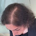 کلینیک پوست، مو، لیزر آنست