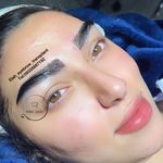 کاشت ابرو الی راز