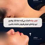 کلینیک زیبایی آرزو