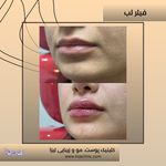 مطب پوست مو زیبایی فردوس شرق