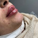 کلینیک زیبایی و مرکز لیزر لاوین